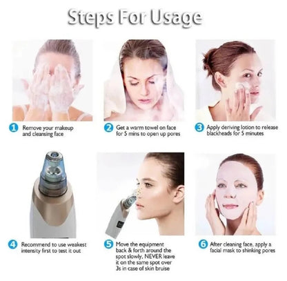 5 in 1 Rechargeable Blackhead Remover|Derma Suction