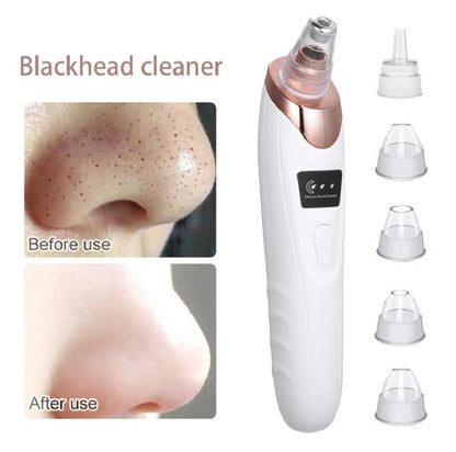5 in 1 Rechargeable Blackhead Remover|Derma Suction