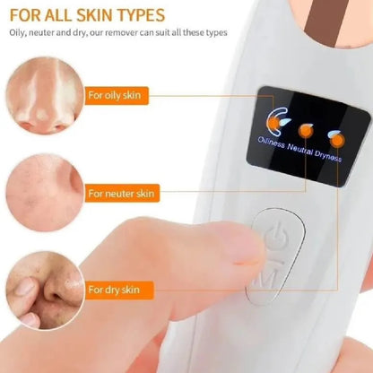 5 in 1 Rechargeable Blackhead Remover|Derma Suction
