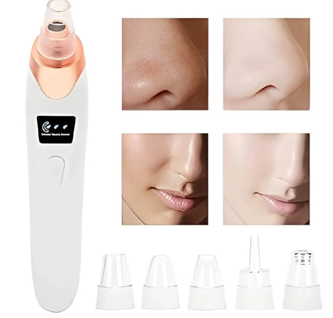 5 in 1 Rechargeable Blackhead Remover|Derma Suction