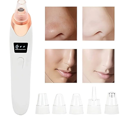 5 in 1 Rechargeable Blackhead Remover|Derma Suction